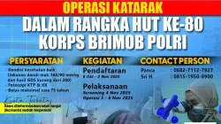RS Bhayangkara Brimob Kelapa Dua Akan Gelar Operasi Katarak Gratis